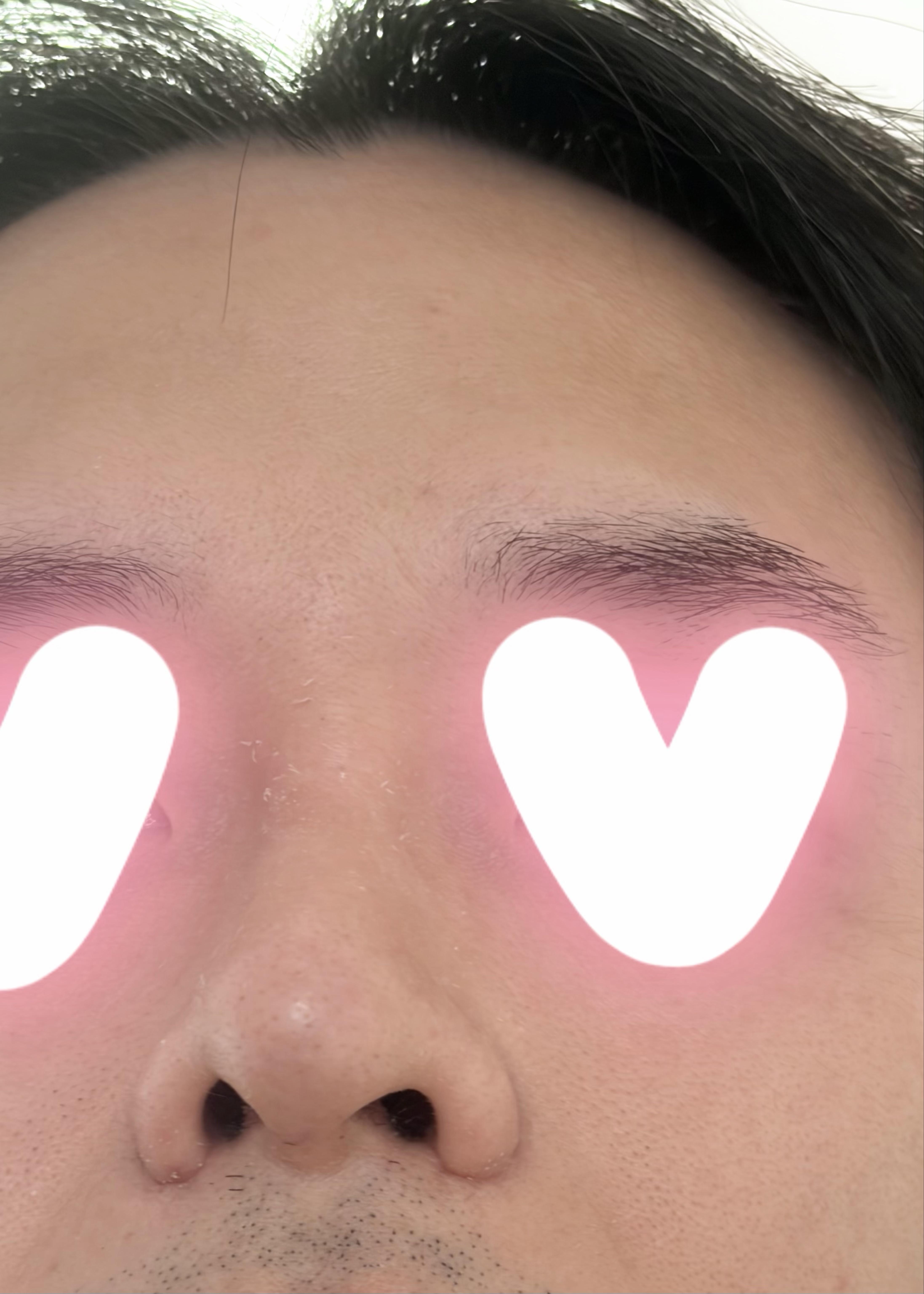 後