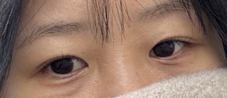 後
