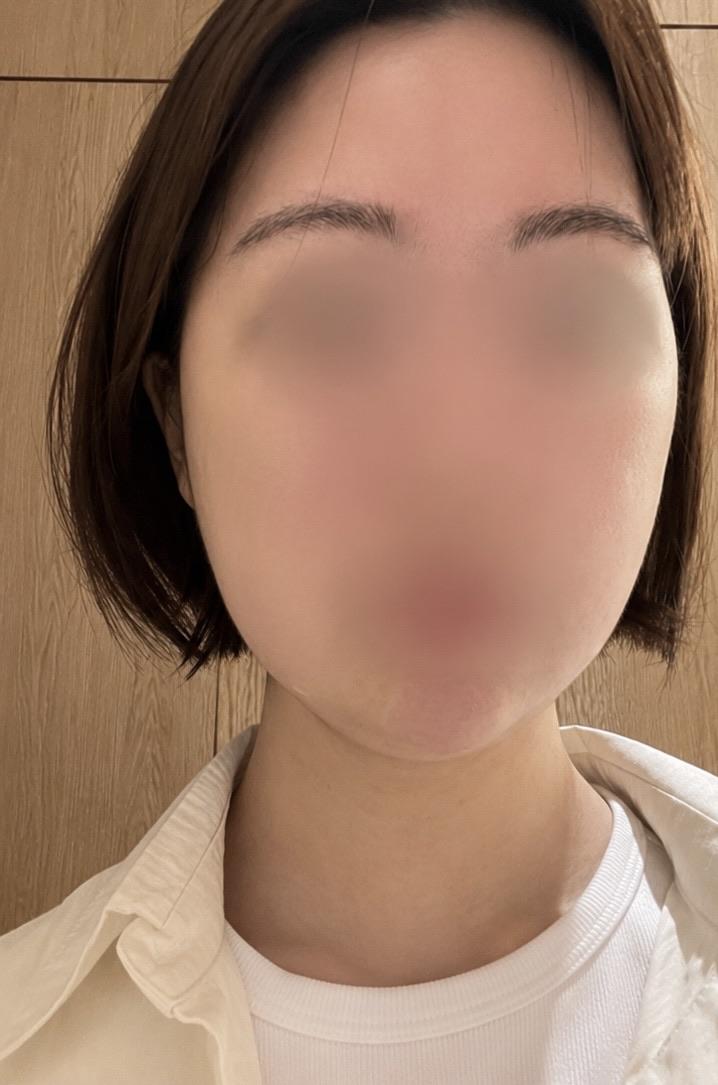 後
