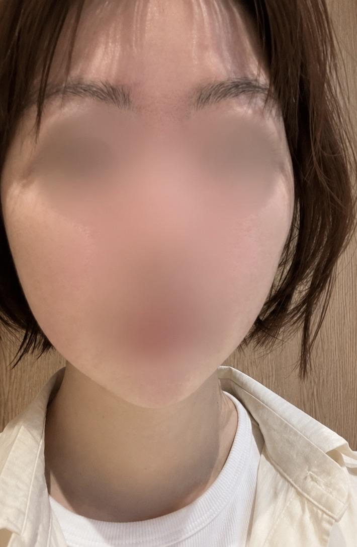 後
