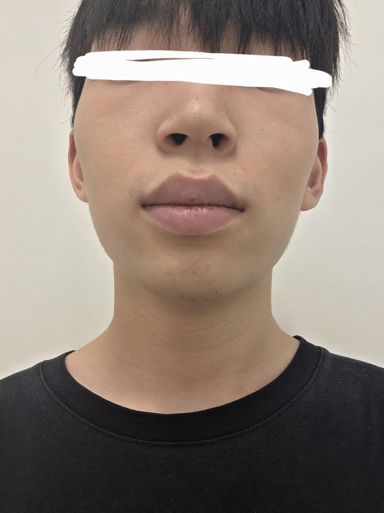 後
