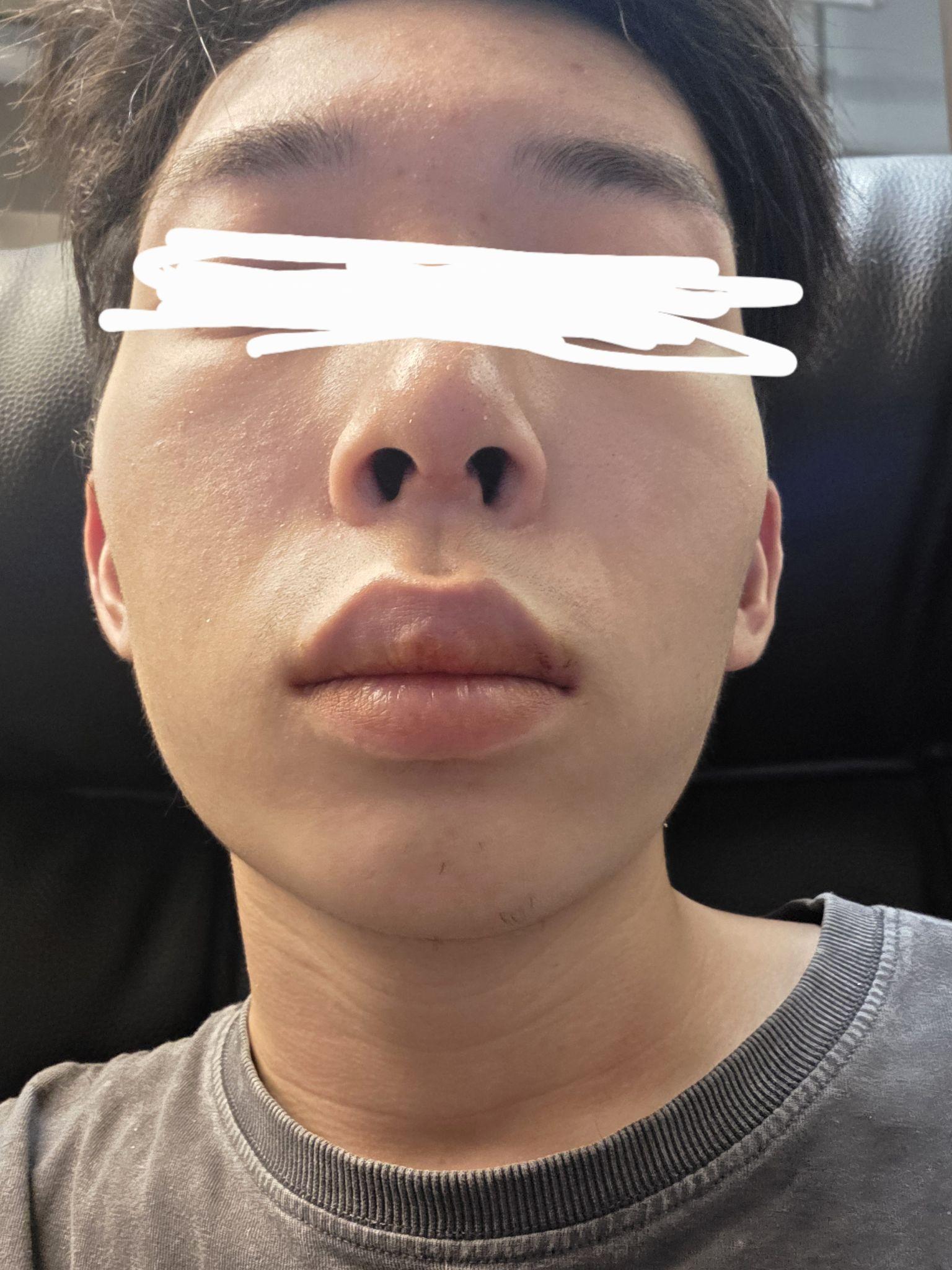 後