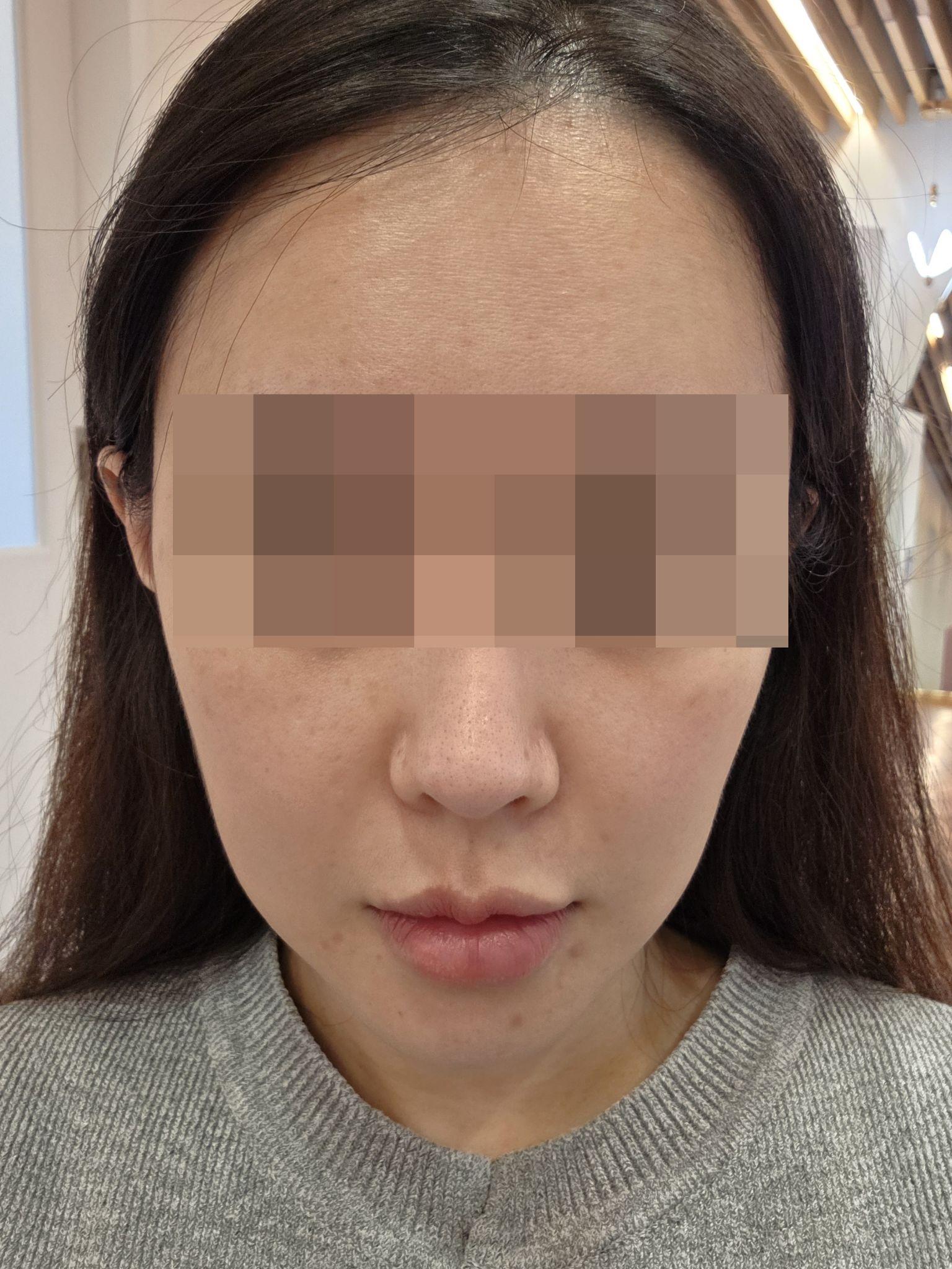 後