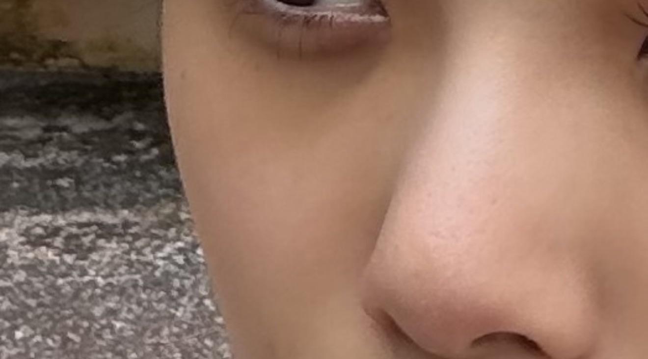 後