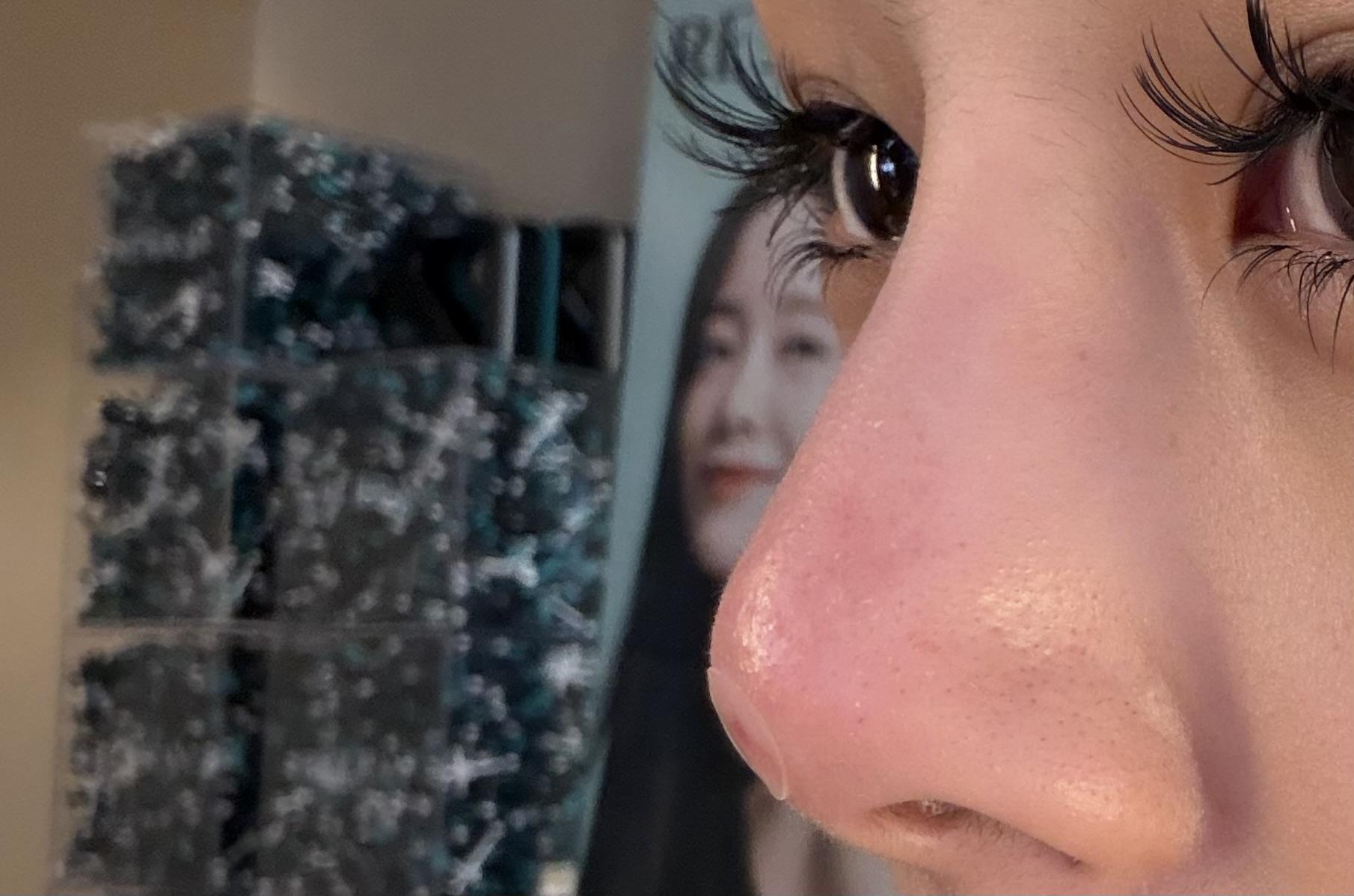 後
