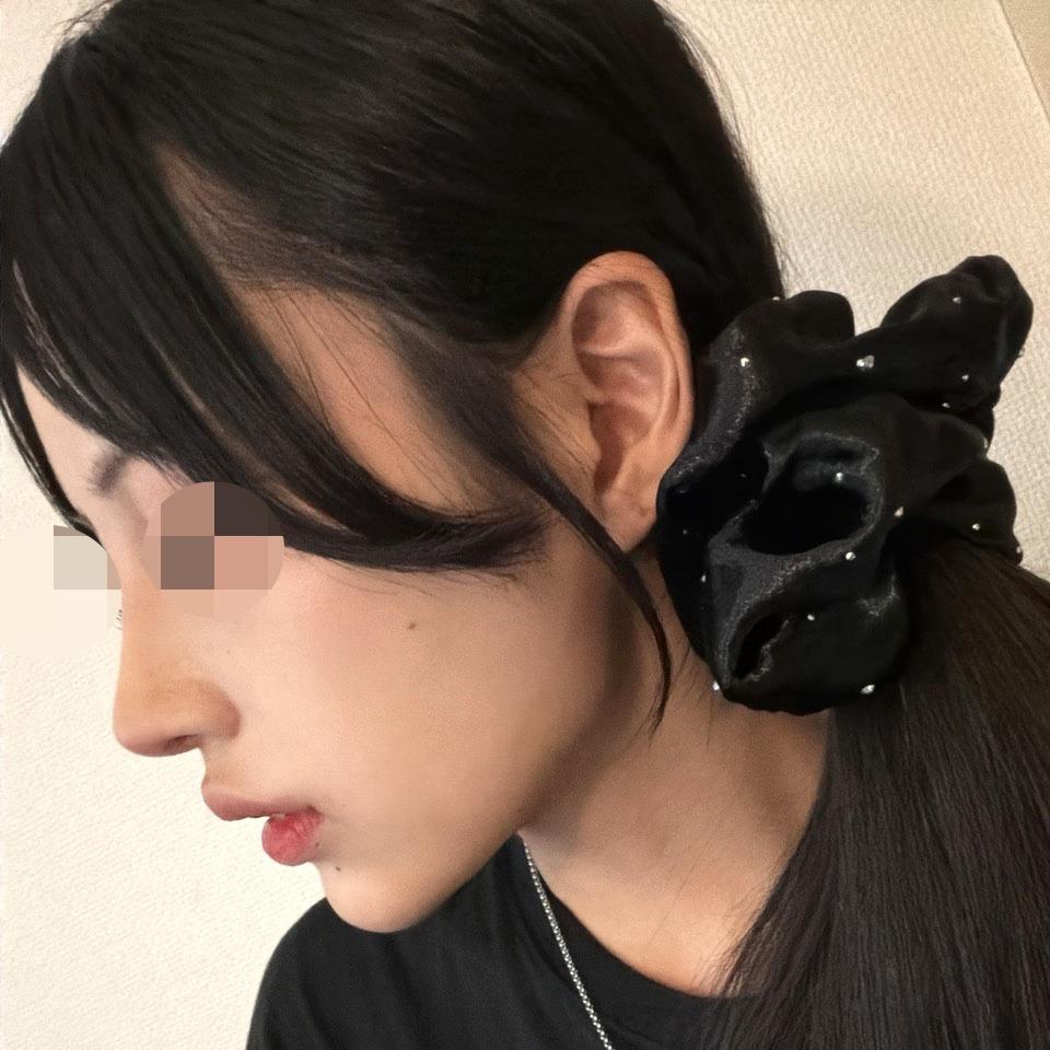 後