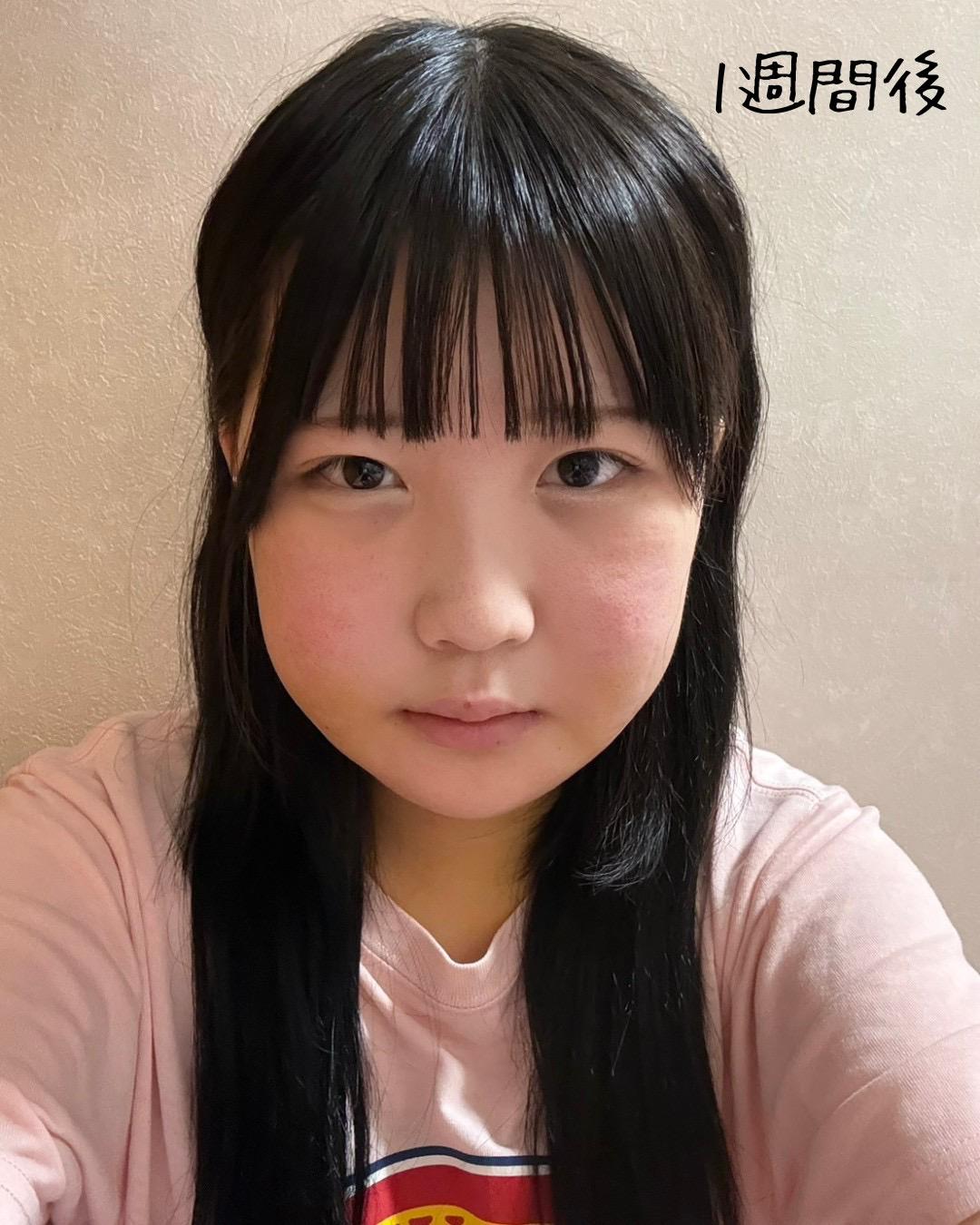 後