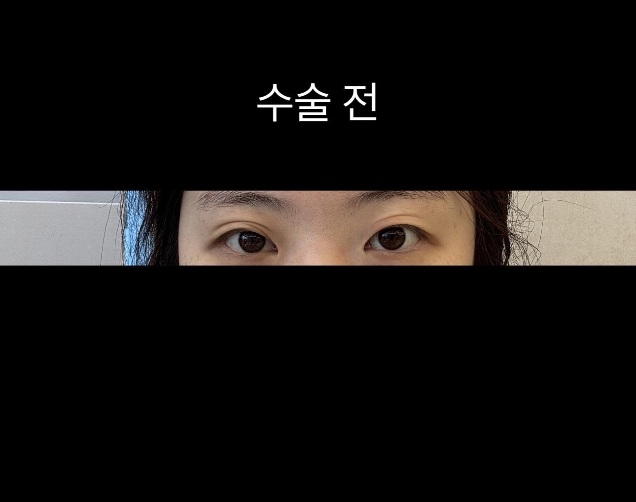 後