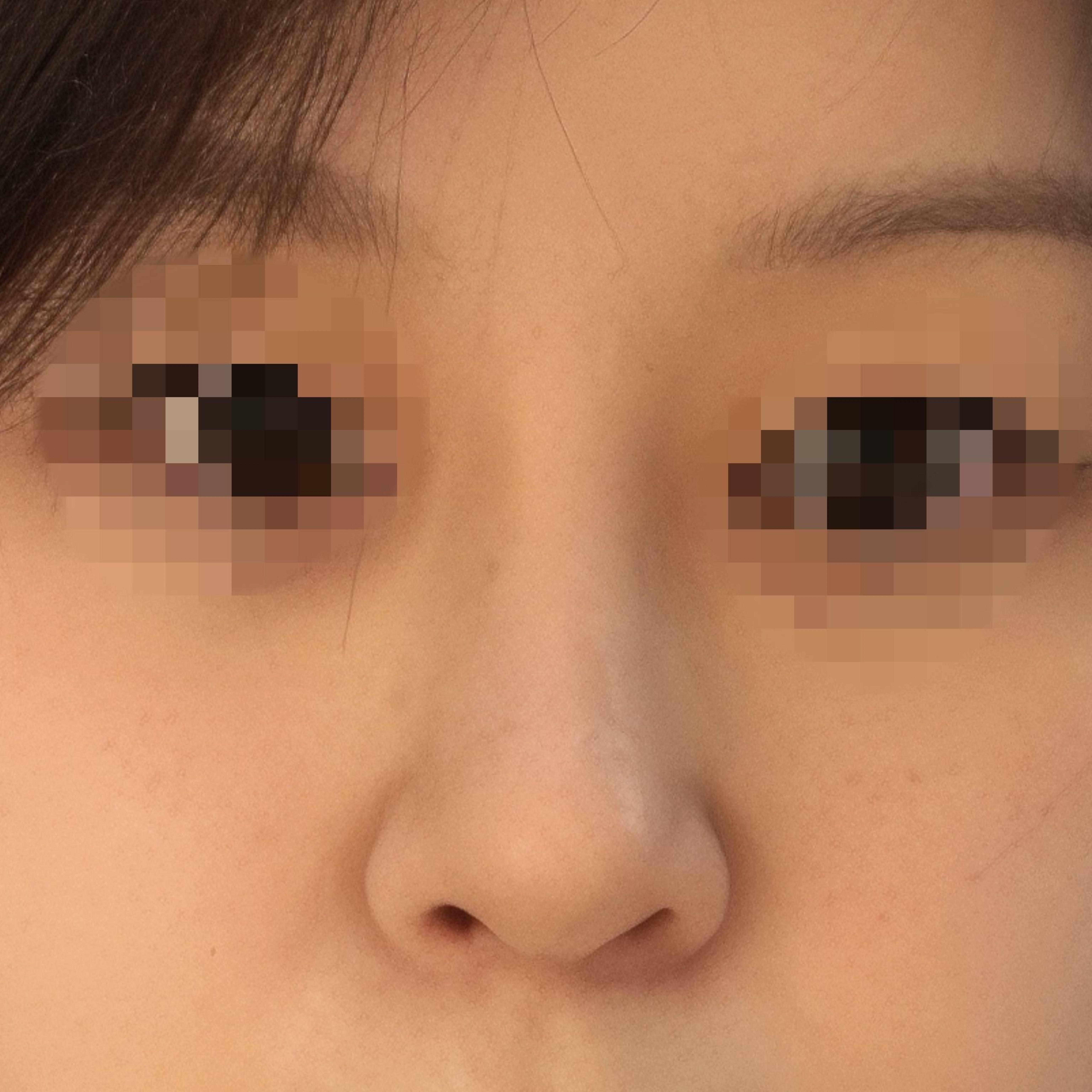 後