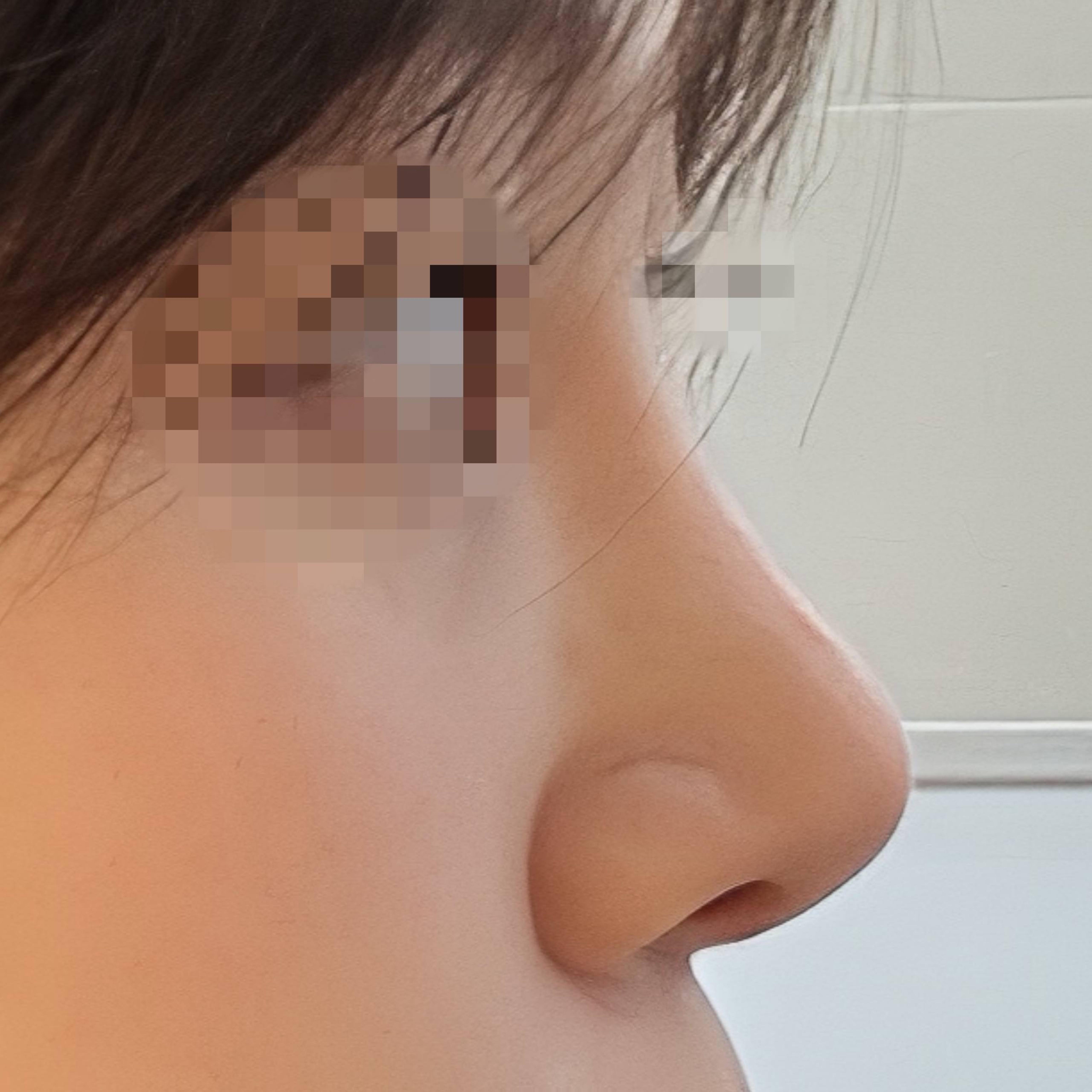 後