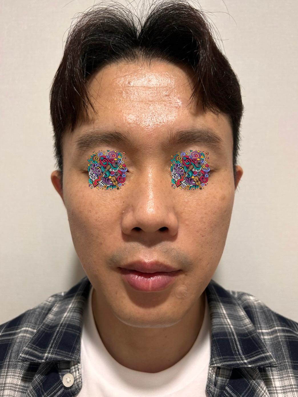 後
