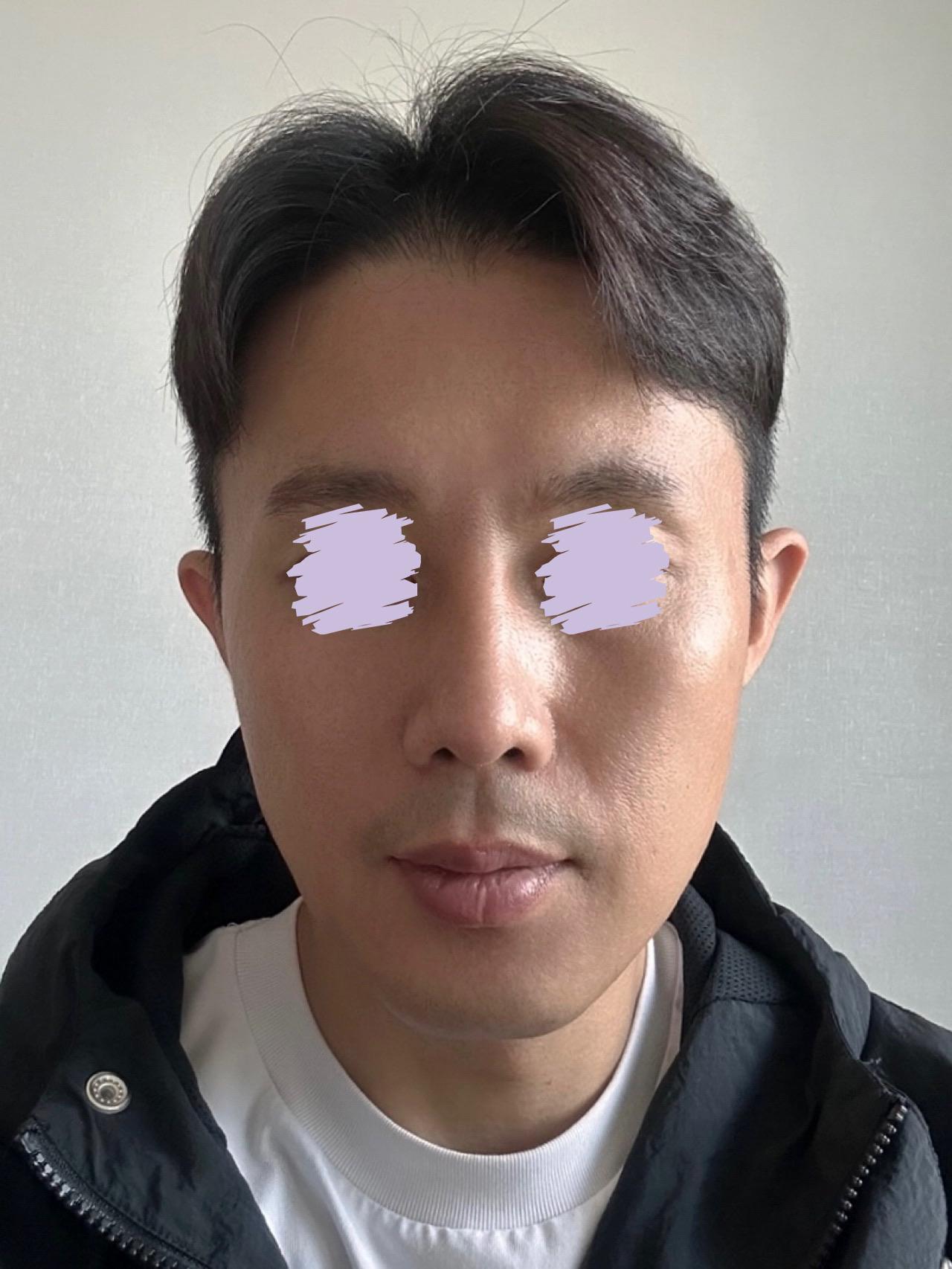 後