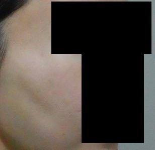 後