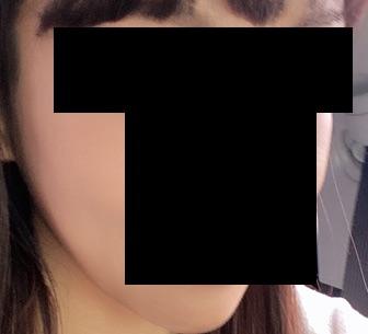 後