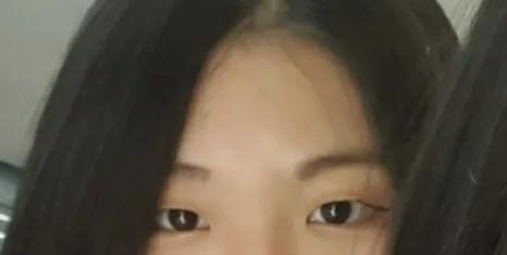 後