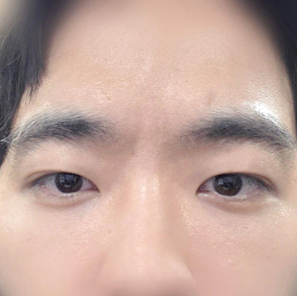 後