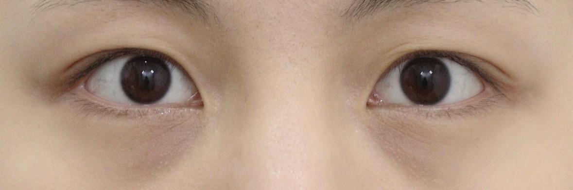 後
