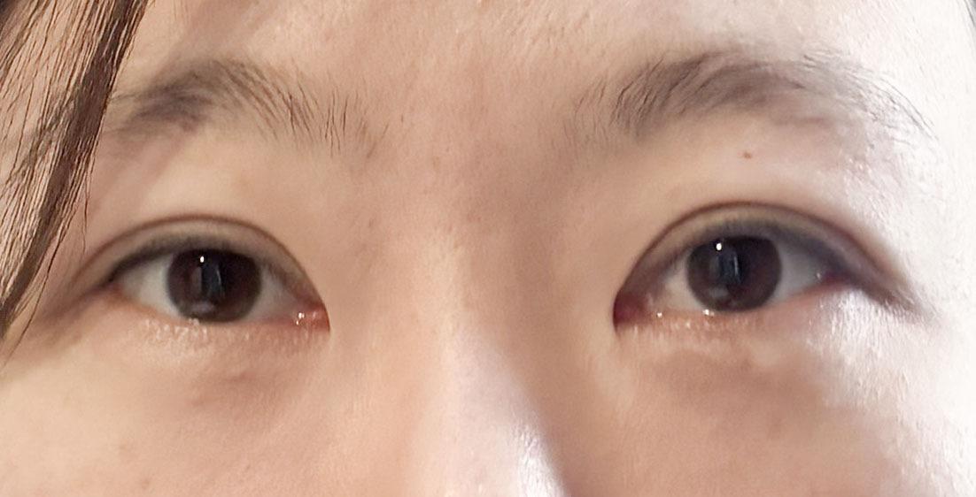 前