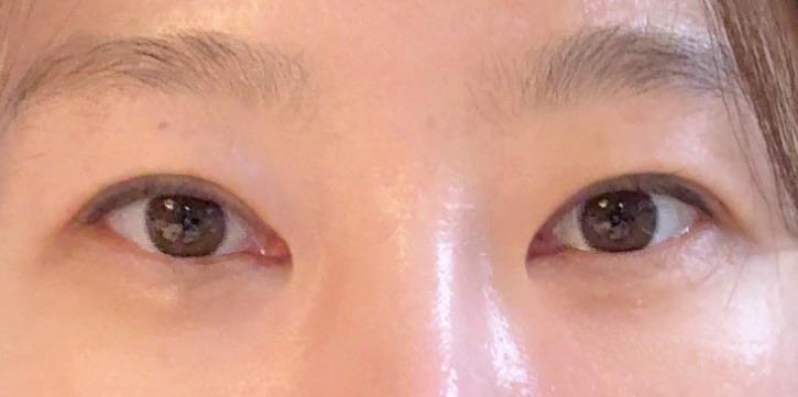 后