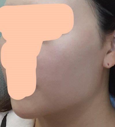 後