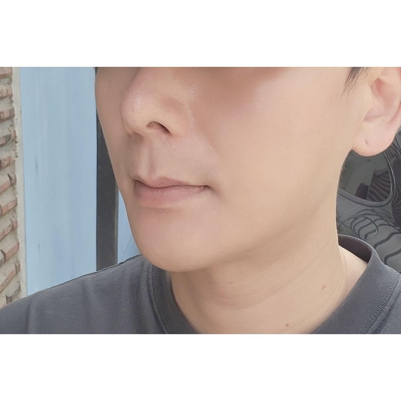 後