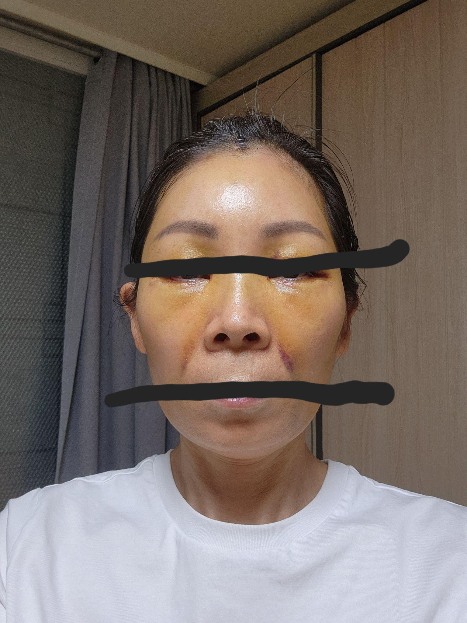 後