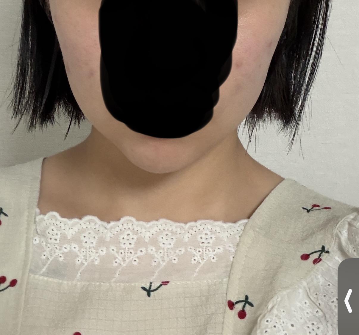 後