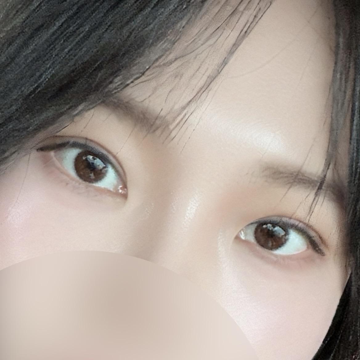 後