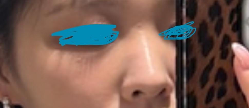 後