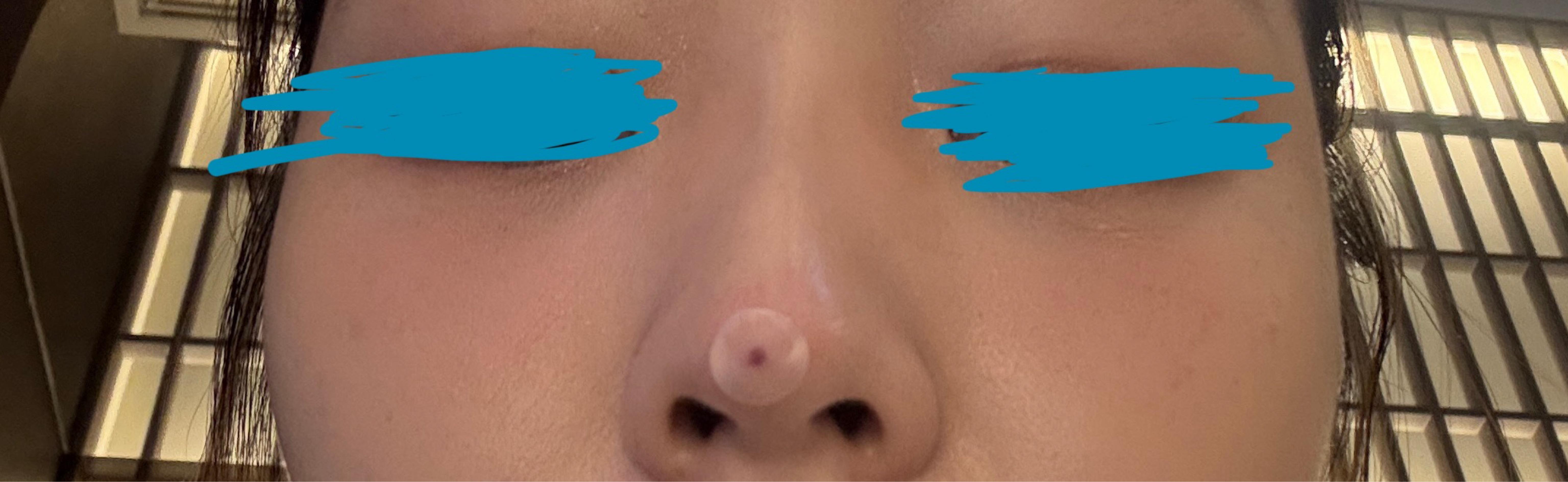 後