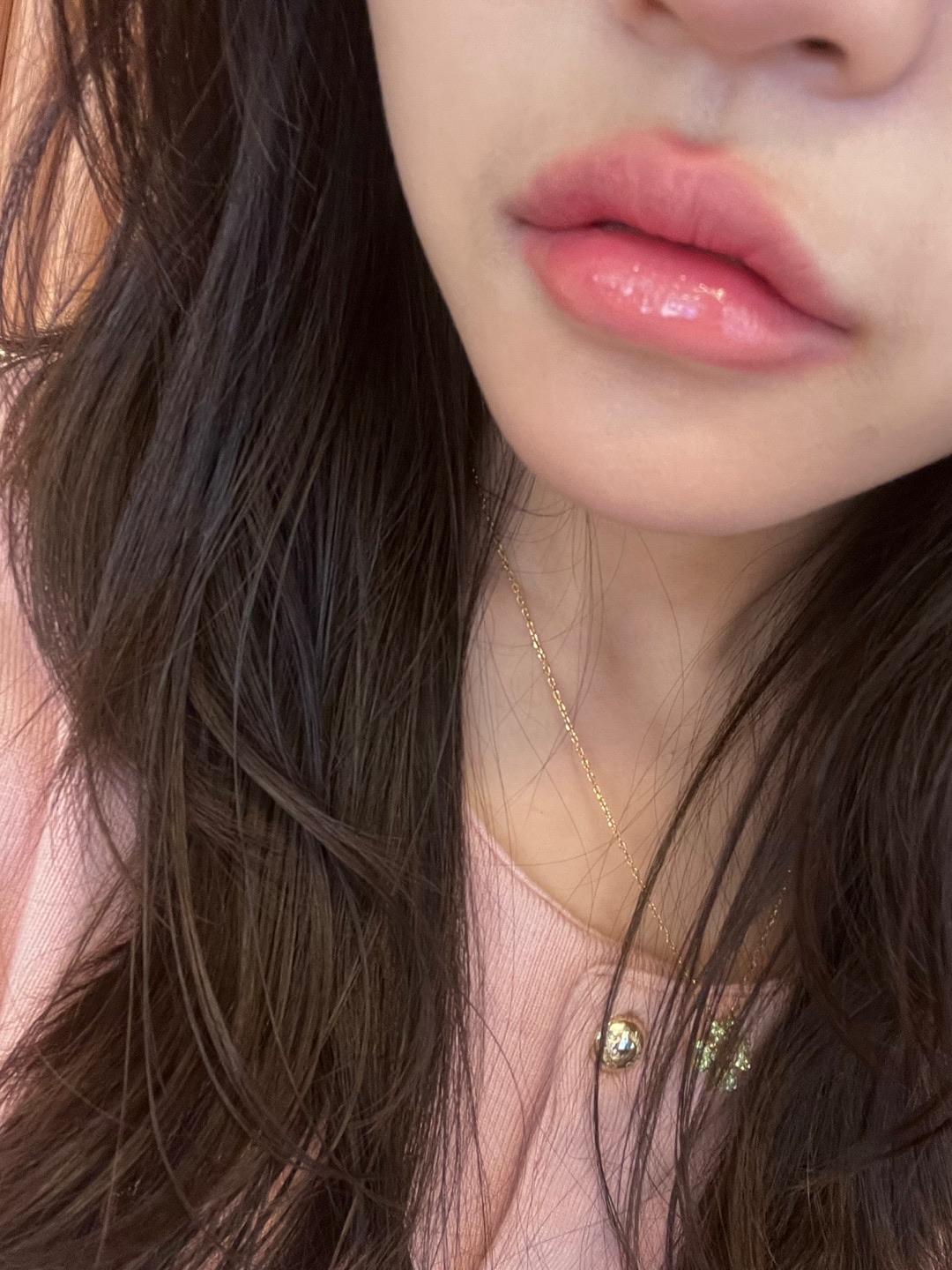 後