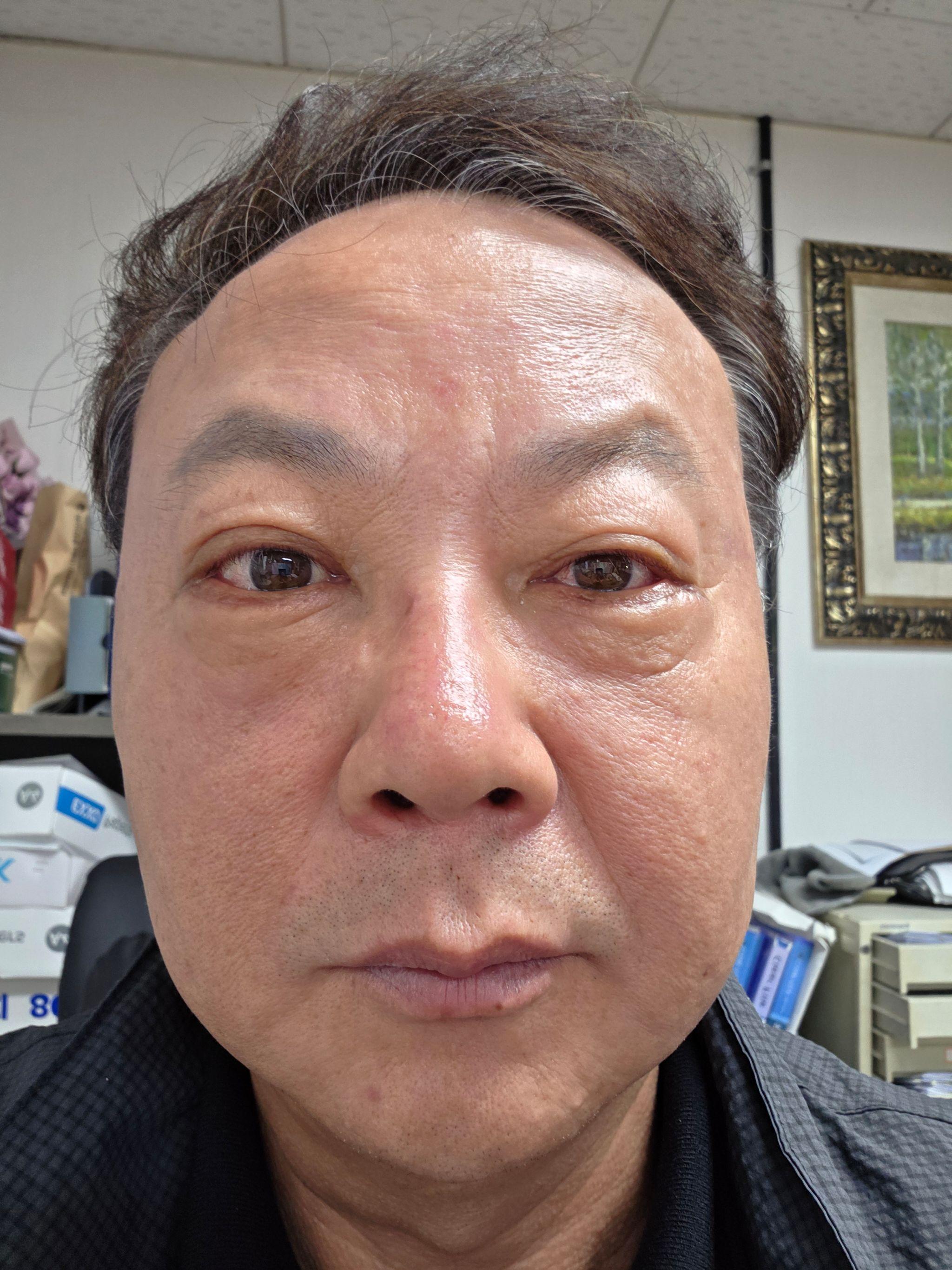 後