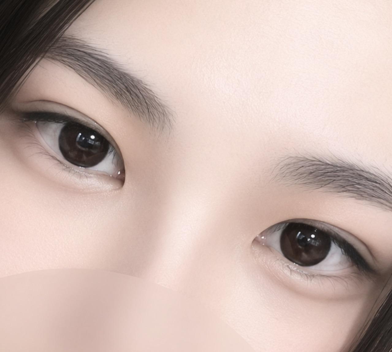 後