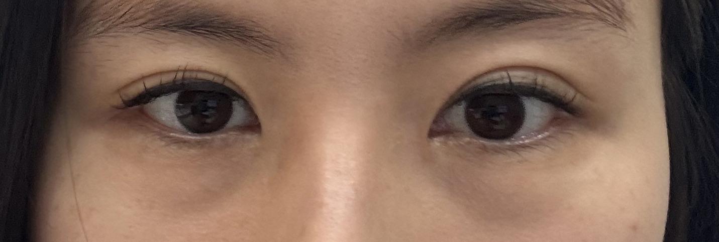 後
