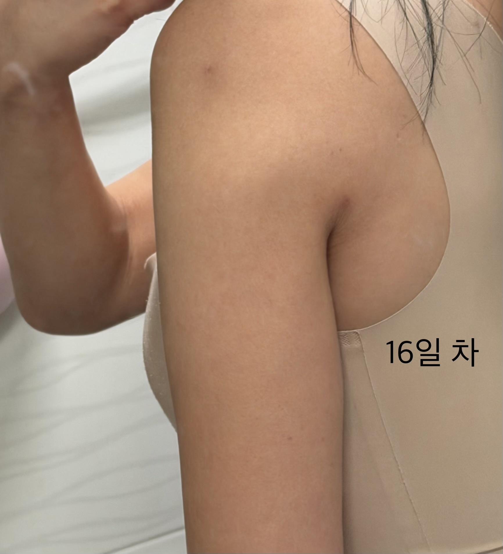 後