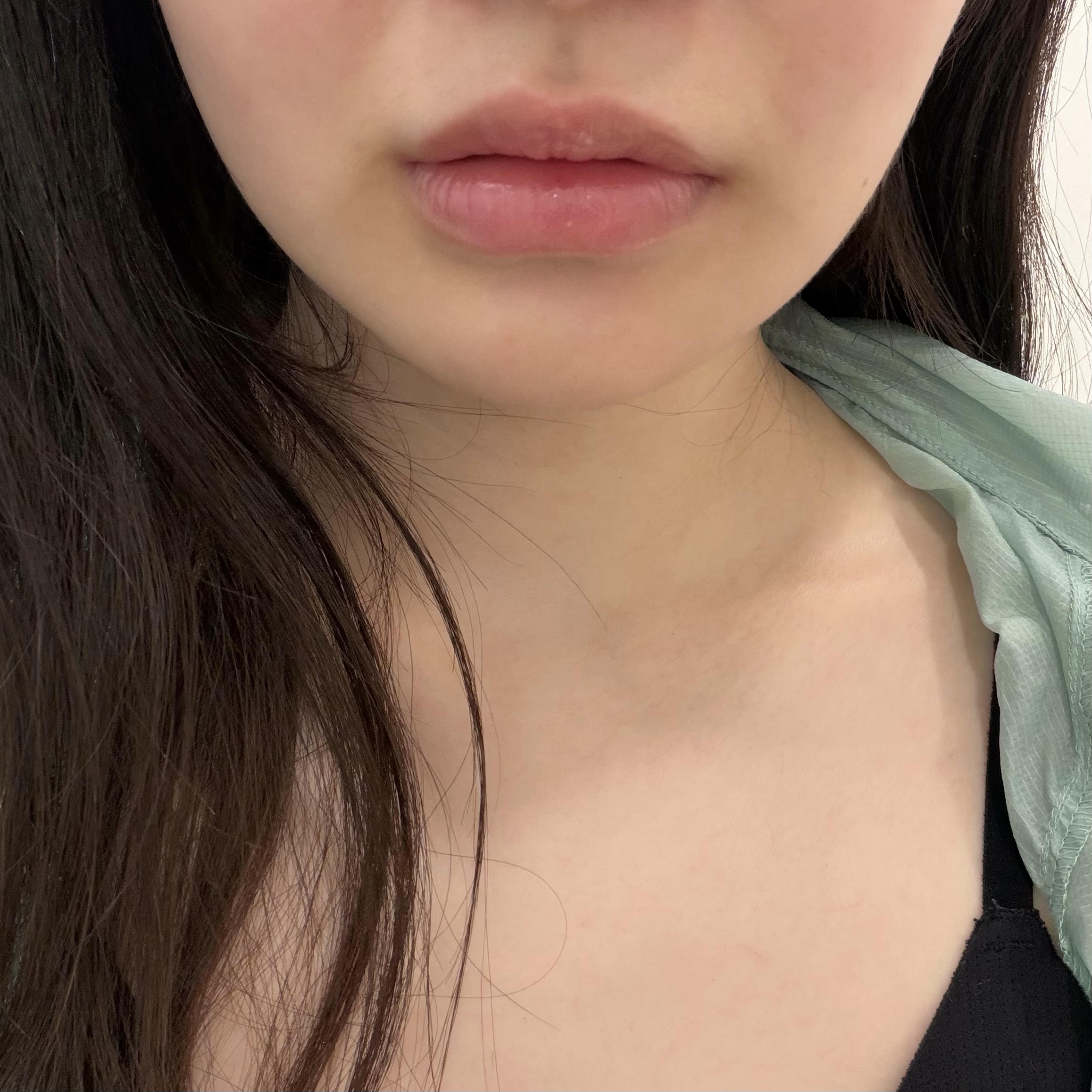後