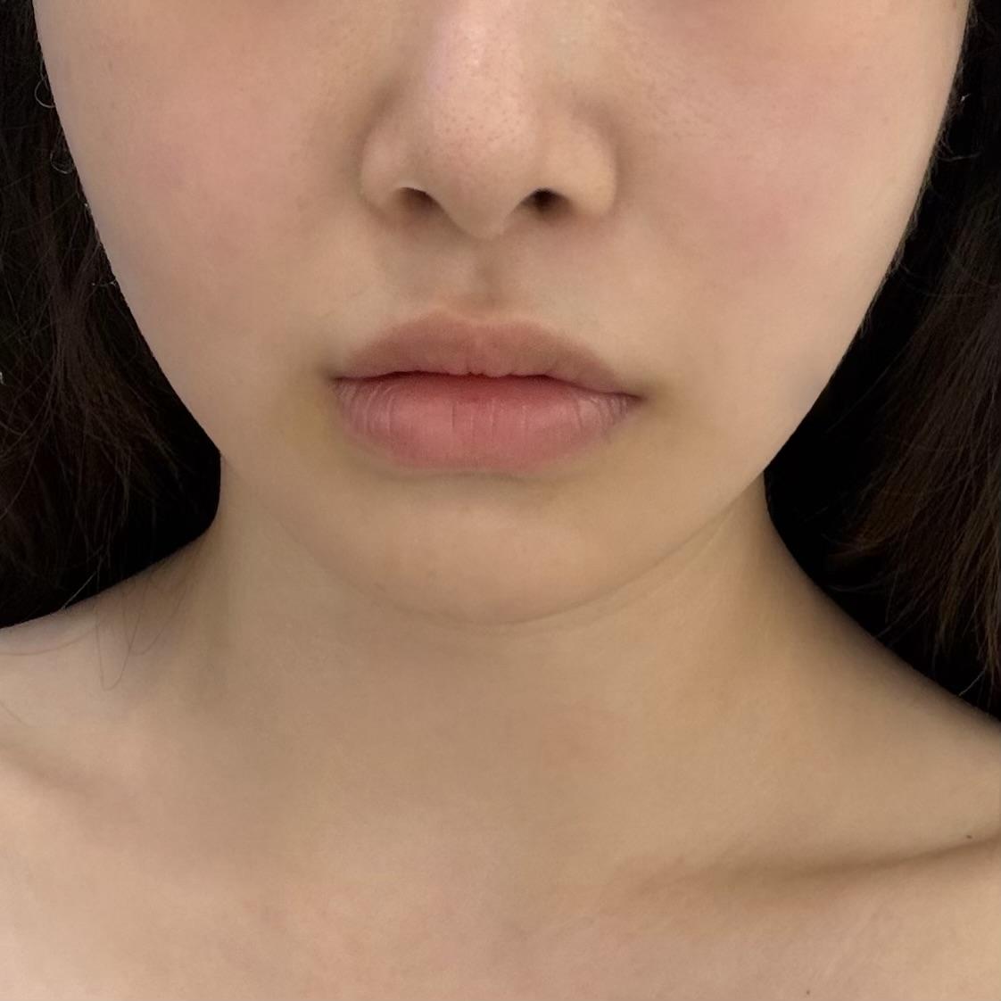 後