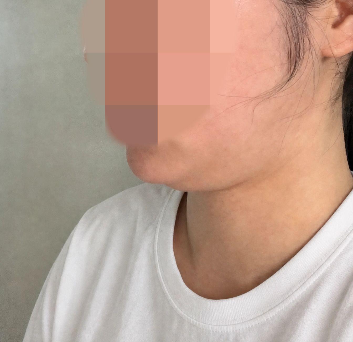 後