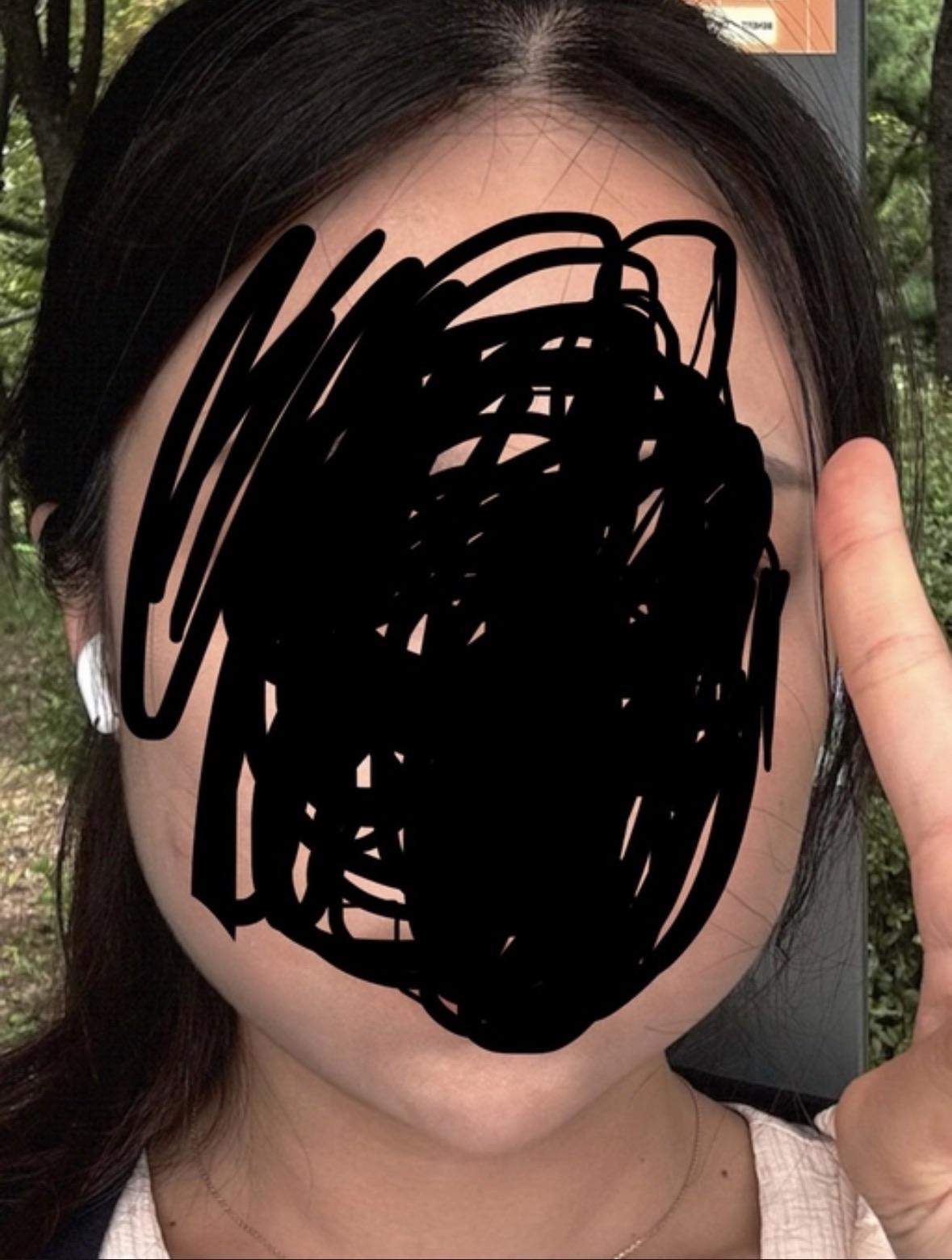 前