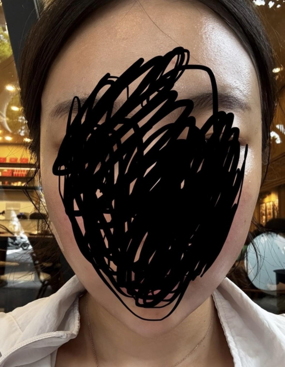 後