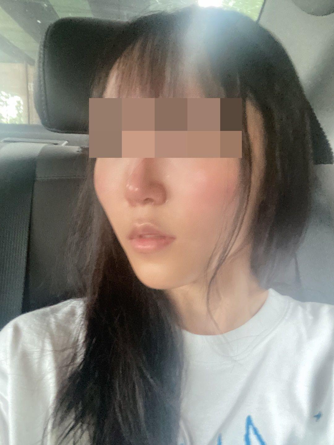 後