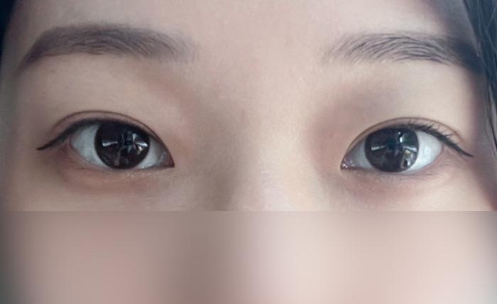 後