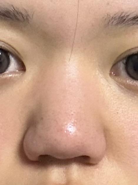 後