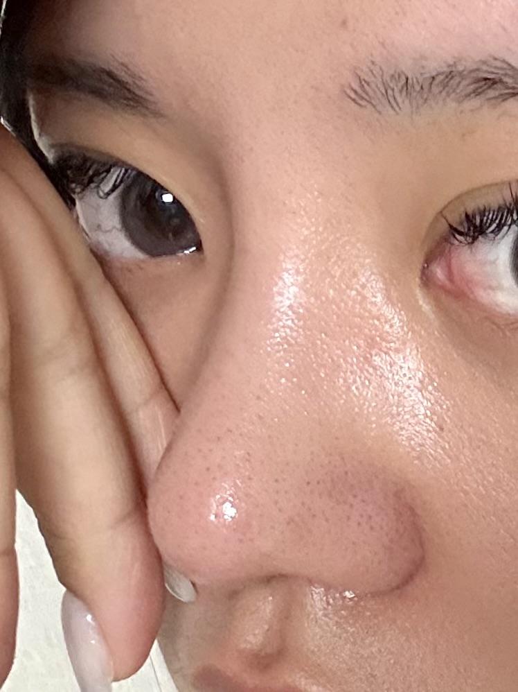 後