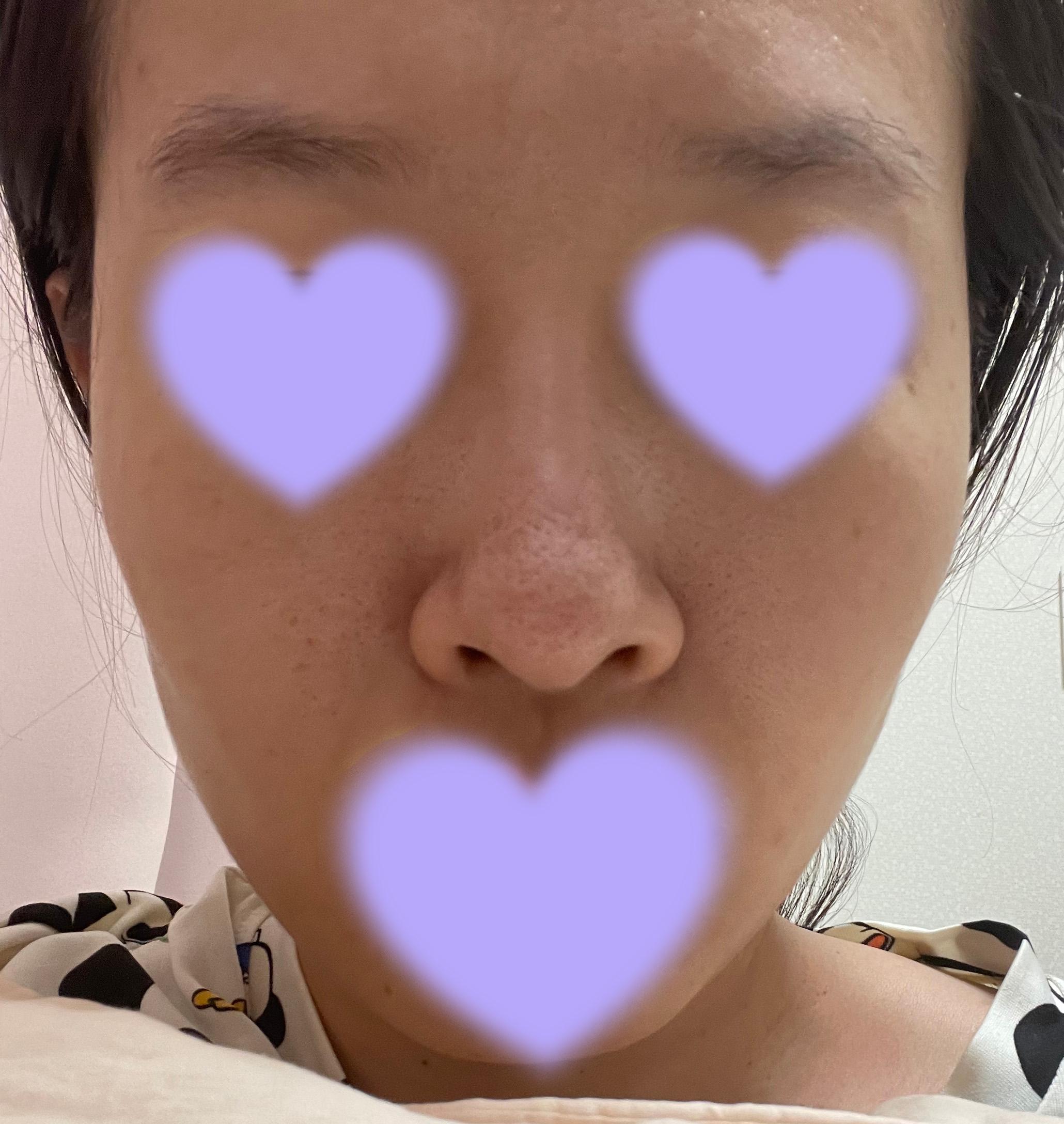 後