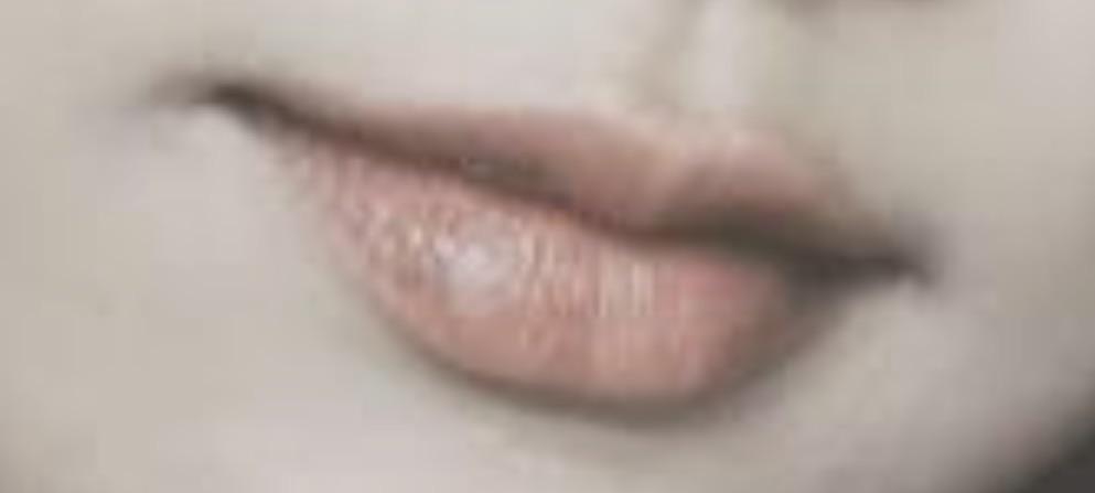 後