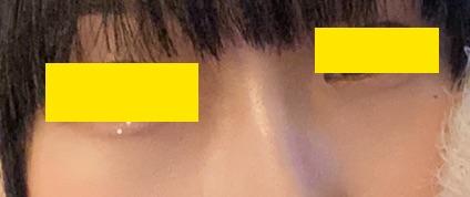 後