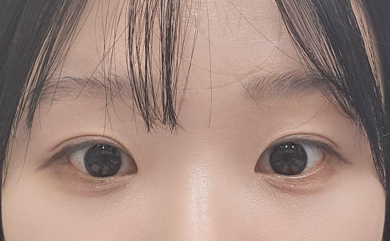 後