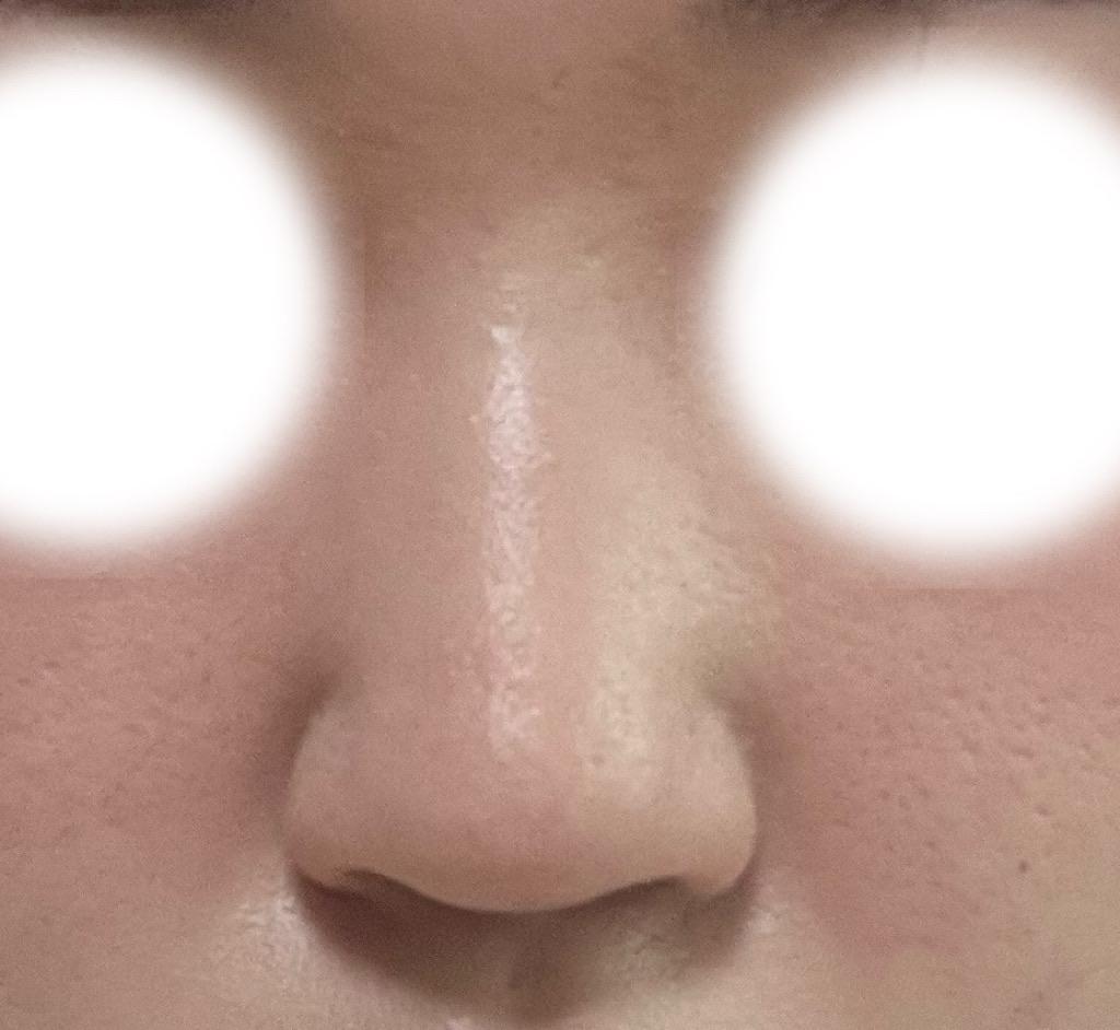 後