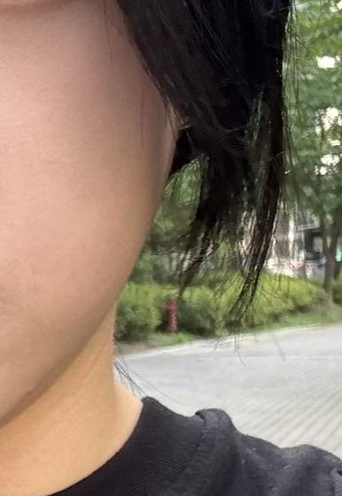 後
